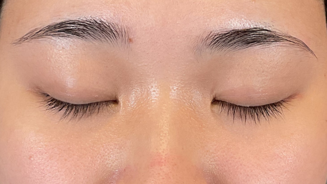 手術前の状態 その1