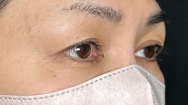 手术前的状态 其一