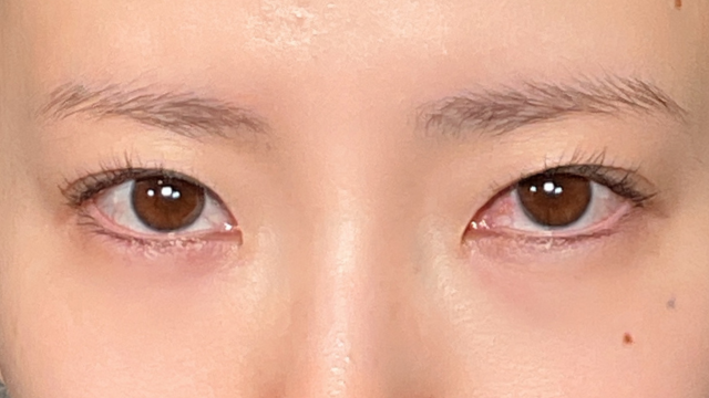 手术前的状态 其一