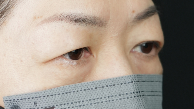 Postoperative Condition Part 1