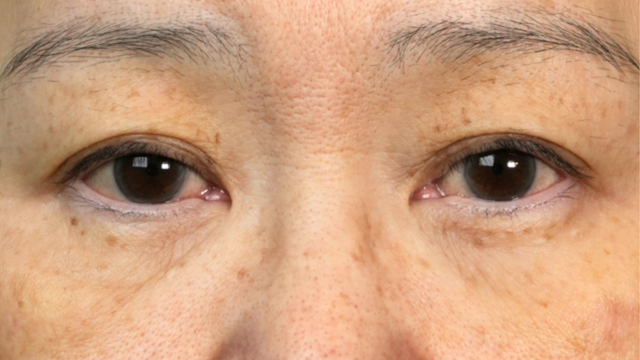 Postoperative Condition Part 1