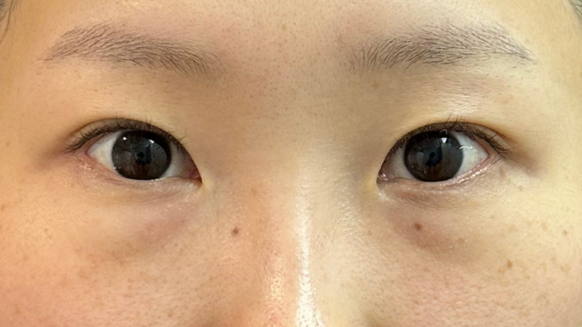 手术前的状态 其一