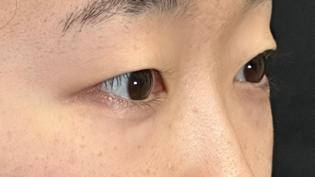 Postoperative Condition Part 1