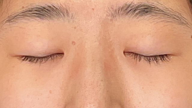 Postoperative Condition Part 1