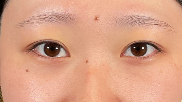 Postoperative Condition Part 1