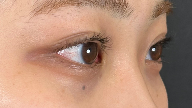 Postoperative Condition Part 1