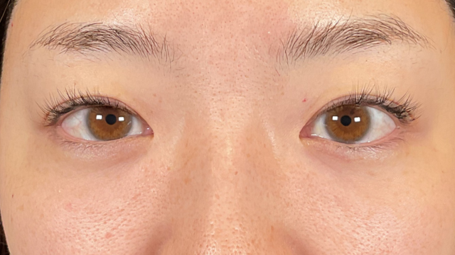 手术前的状态 其一