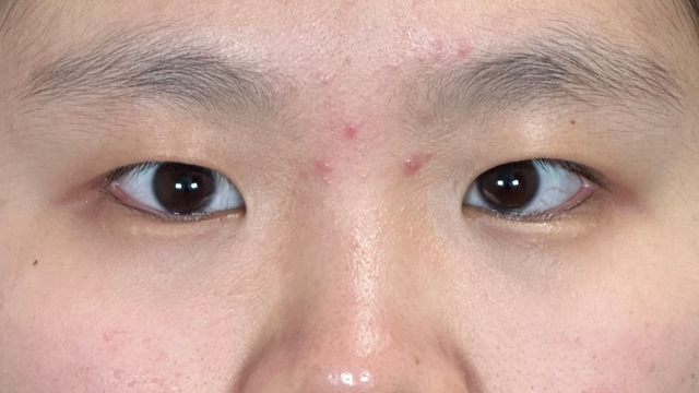 手术前的状态 其一