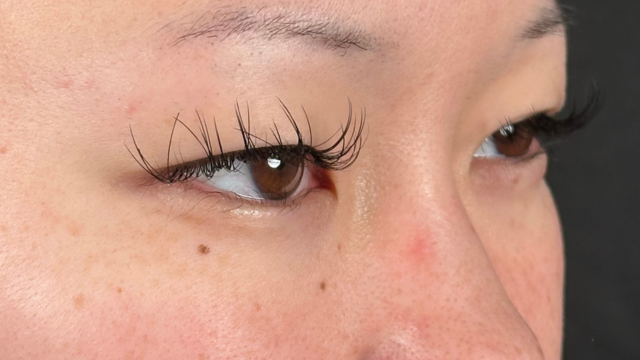 手术前的状态 其一