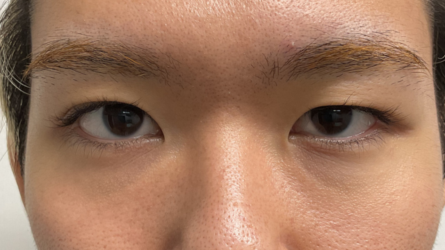 Postoperative Condition Part 1