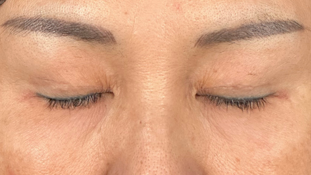 Postoperative Condition Part 1