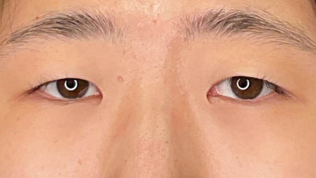 Postoperative Condition Part 1