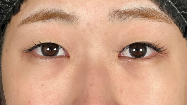 手术前的状态 其一