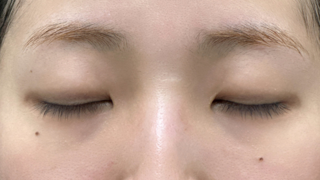 手术前的状态 其一