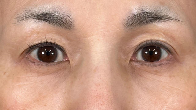 手術前の状態 その1