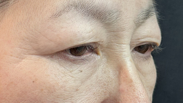 手术前的状态 其一