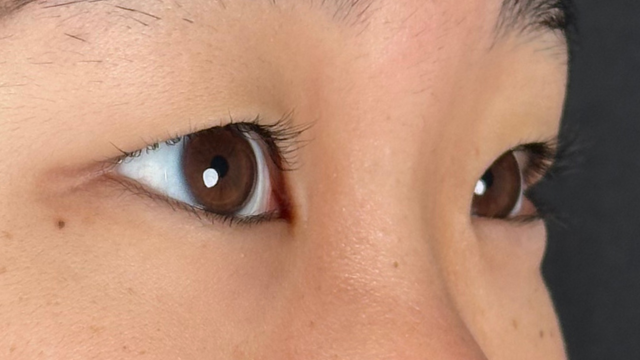 手术前的状态 其一