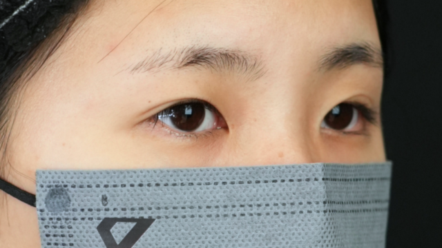 手术前的状态 其一