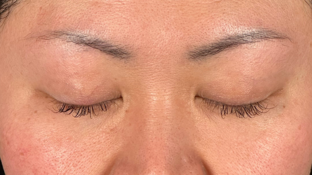 Postoperative Condition Part 1