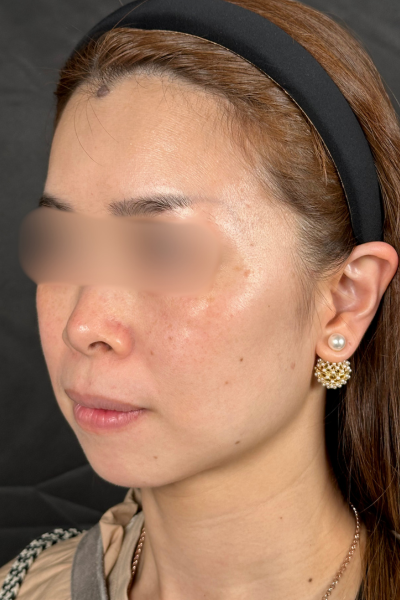 Postoperative Condition Part 1