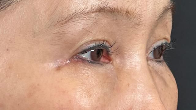 手术前的状态 其一