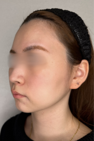 手術前の状態 その1