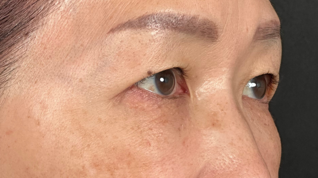 手術前の状態 その1