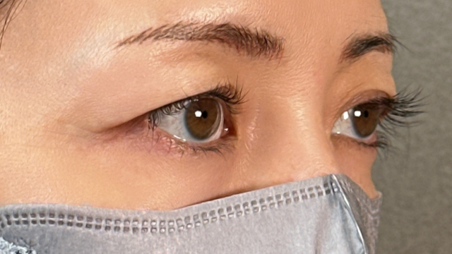 Postoperative Condition Part 1