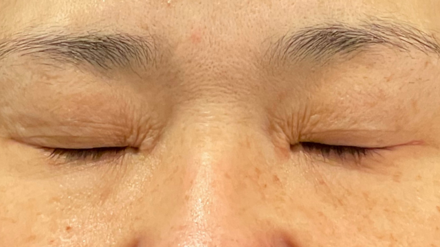 Postoperative Condition Part 1