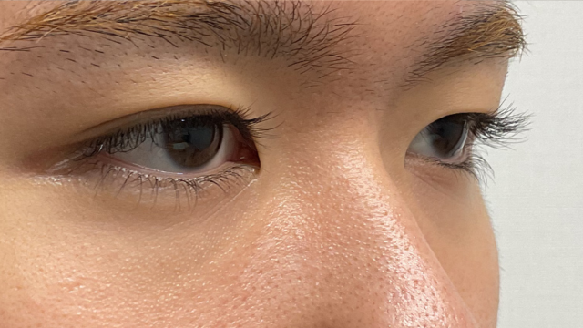 Postoperative Condition Part 1