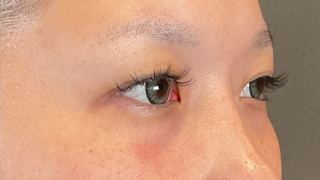 Postoperative Condition Part 1