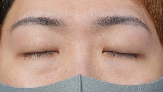 手术前的状态 其一