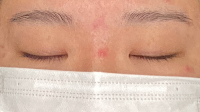 手術前の状態 その1