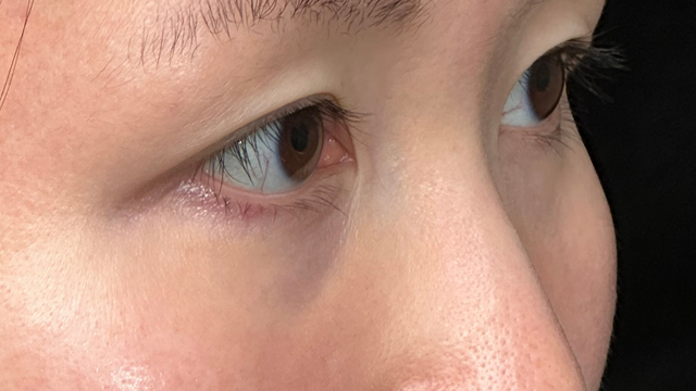 Postoperative Condition Part 1