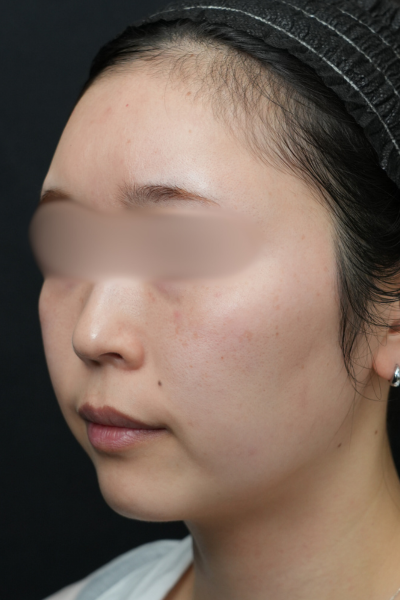 Postoperative Condition Part 1