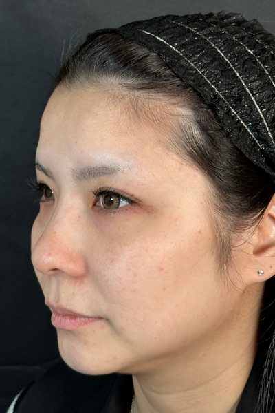 手术前的状态 其一