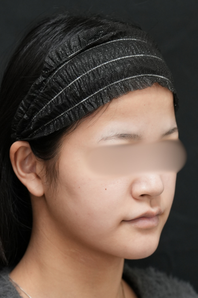 手術前の状態 その1