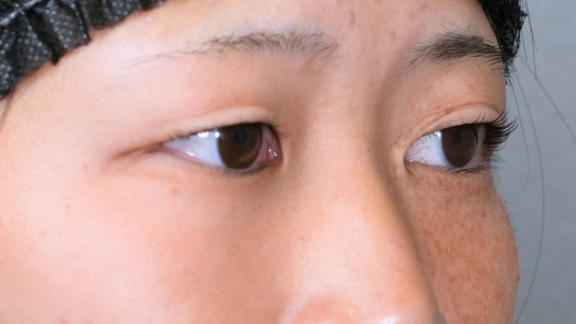 Postoperative Condition Part 1