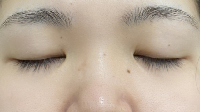 手术前的状态 其一