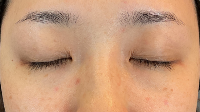 手术前的状态 其一