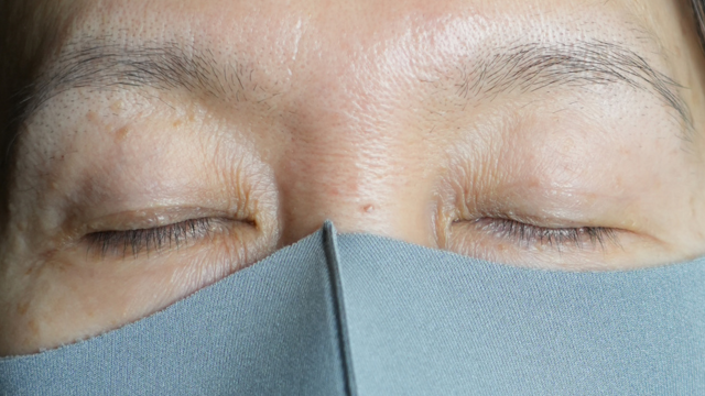 手术前的状态 其一