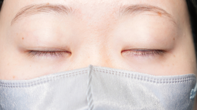 手術前の状態 その1