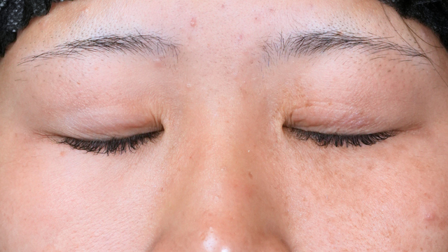 Postoperative Condition Part 1