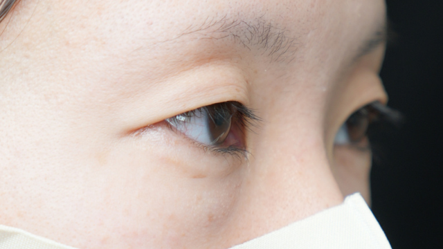 手术前的状态 其一