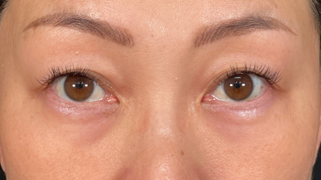 Postoperative Condition Part 1