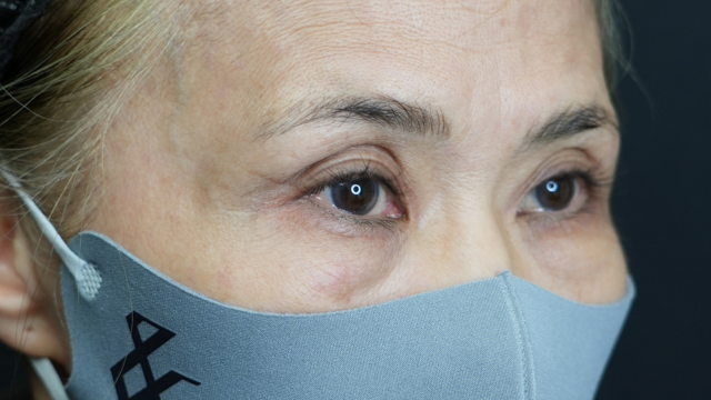 手术前的状态 其一