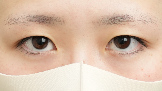 手术前的状态 其一