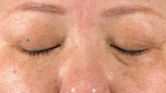 Postoperative Condition Part 1