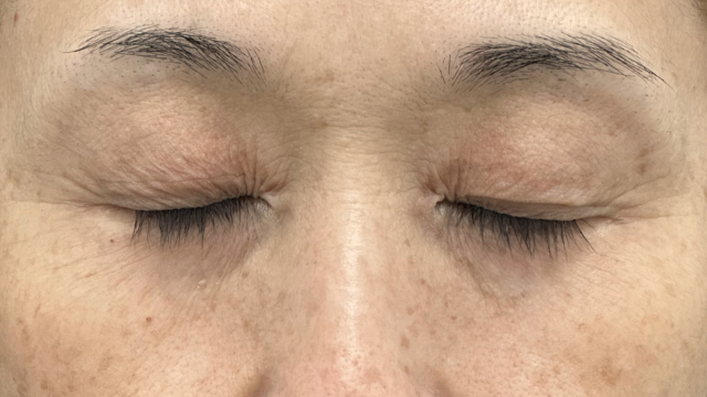 手术前的状态 其一