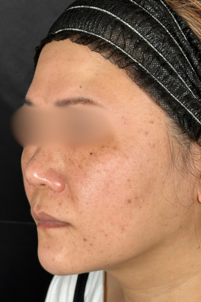 手術前の状態 その1